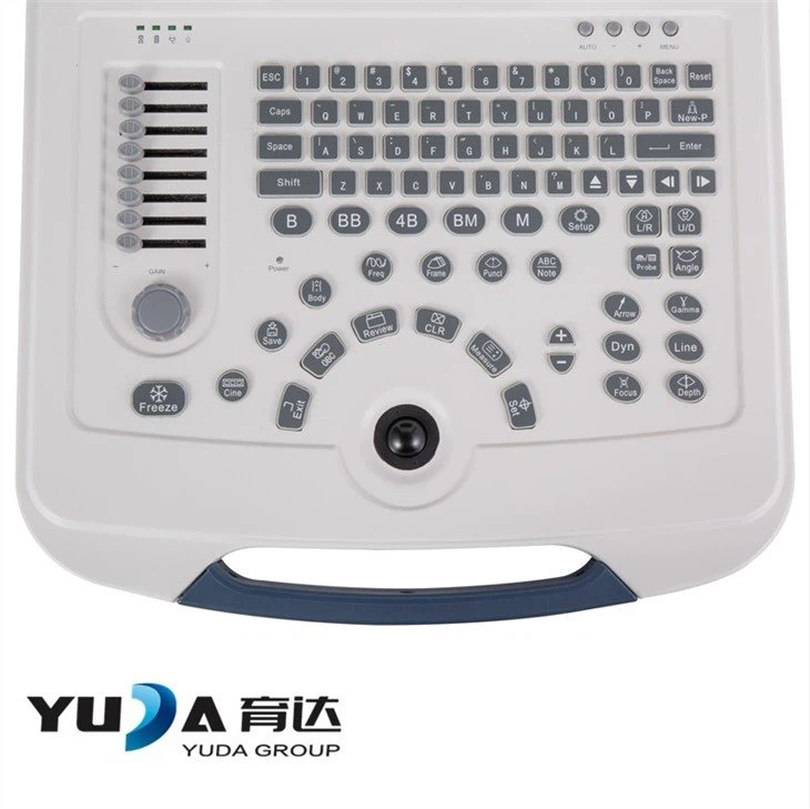 Full Digital Laptop High-end Ultrasound 3D Scanner